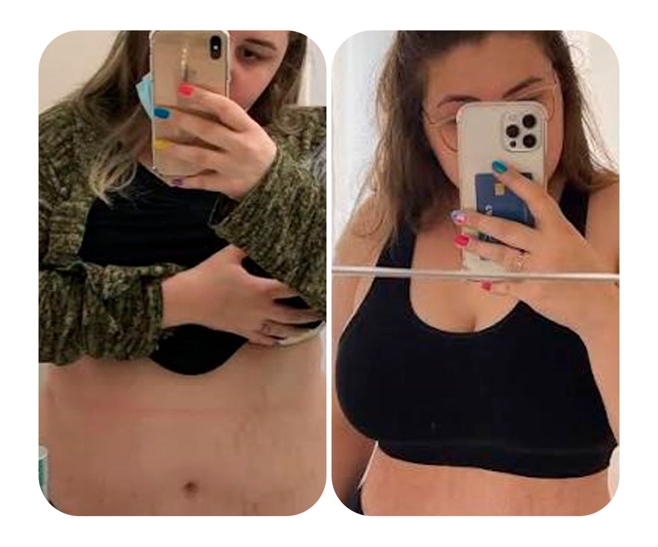 Depoimento 2 — Redução moderada na região abdominal